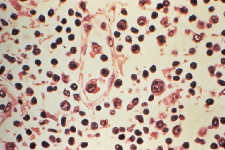 Hantavirus : de la souche Andes au taux de létalité, le lexique pour comprendre les mots qui circulent avec ce virus